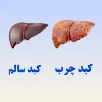 پاکسازی کبد و معده ،ریزش مو ، لک های پوستی|خدمات آرایشگری و زیبایی|آمل, |دیوار