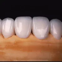 دندانپزشکی و دندانسازی نیکا