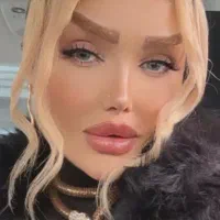 کوچک کردن بینی تضمینی  با ۵/۵۰۰ م  با متدی انحصاری