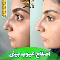 تزریق انواع بوتاکس  ژل آنزیم بینی نخ جوانسازی|خدمات آرایشگری و زیبایی|صدرا-فارس, فاز ۱|دیوار