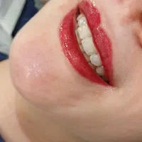 شیدلب فقط ۸۰۰ تومن