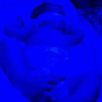 اجاره دستگاه فتوتراپی زردی نوزاد