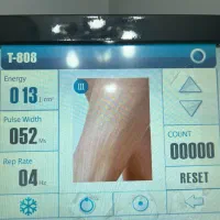 دستگاه لیزر دایود الکس وارداتی اصل اکراین|پزشکی|نوشهر, |دیوار