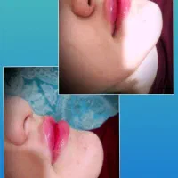 خدمات ژل و بوتاکس و تاتو صورت و بدن