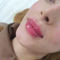 تزریق ژل و بوتاکس و هایفوتراپی پروفایلو فیلر بادی|خدمات آرایشگری و زیبایی|شیراز, فرهنگ شهر|دیوار