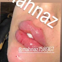 چشم گربه ای،بوتاکس،لب روسی790