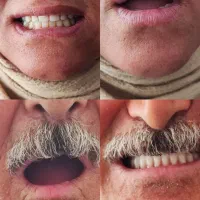 دندانسازی تجربی یزدانی