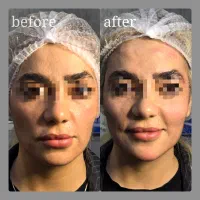 جشنواره تخفیف هفتگی ویژه نخ،مادلینگ فول فیس|خدمات آرایشگری و زیبایی|شاهین‌شهر, فردوسی|دیوار