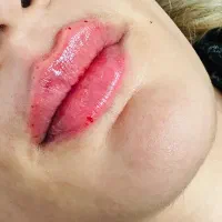 مدل فیلر لب نوشهر