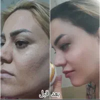 سه روزه سفید برفی شو