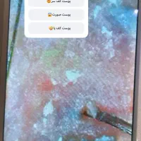 فقط چند روز **آنالیز رایگان**کف سر ظرفیت محدود