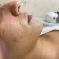 فیشال درمانی تخصصی|خدمات آرایشگری و زیبایی|بندر ماهشهر, |دیوار