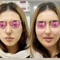 خدمات تخصصی پوست و مو در کلینیک فرسیما|خدمات آرایشگری و زیبایی|اسلام‌شهر, باغ فیض|دیوار