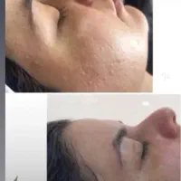 زیبایی فلورین ایثار