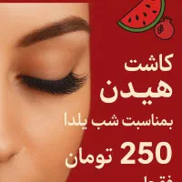 کاشت مژه به روش هیدن