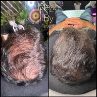 خدمات پاکسازی پوست و مزوتراپی مو