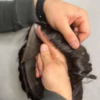 کاشت مو به روش پروتزمو|خدمات آرایشگری و زیبایی|شیراز, قدوسی شرقی|دیوار