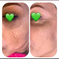 ریمو تتو.کربن ترابی صورت.روشنکردن نواحی تیره|خدمات آرایشگری و زیبایی|قم, باجک دو|دیوار