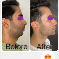 جشنواره فول فیس توسط پزشک متخصص