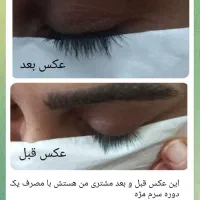 مشاور پوست و مو|آرایشی، بهداشتی، درمانی|قم, وادی السلام|دیوار