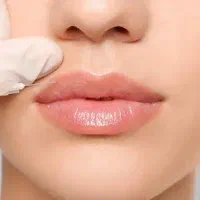 تزریق ژل برای پر کردن اسکار