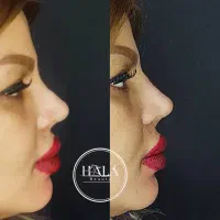 خدمات زیبایی صورت|خدمات آرایشگری و زیبایی|آبادان, |دیوار