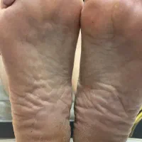 پدیکور پا برای بانوان عزیز|خدمات آرایشگری و زیبایی|قم, شهرک قدس|دیوار