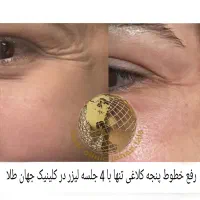 کلینیک لیزر پوست،مو جهانطلا در کرمانشاه (فوتونا)