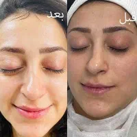 مدل رایگان