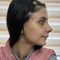 عمل بینی ۲۱ تومن