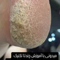 آموزش و خدمات پدیکور تخصصی به سبک روسی|خدمات آرایشگری و زیبایی|خوی, |دیوار