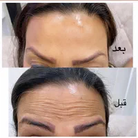 لیزر خال برداری.جوانسازی شهرری|خدمات آرایشگری و زیبایی|ری, جوانمرد قصاب|دیوار