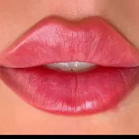 اموزش ژل فیلر بوتاکس نخ پی ارپی