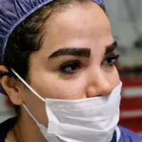 کاشت ابرو با بیشترین تراکم