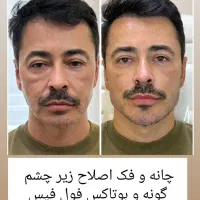 کلاس زیبایی برای همه|خدمات آموزشی|کرمانشاه, |دیوار