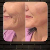 کرم رفع چین و چروک صورت|آرایشی، بهداشتی، درمانی|تبریز, |دیوار