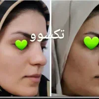 خیلی راحت بدون رژیم سخت چربیسوزی کن|آرایشی، بهداشتی، درمانی|سبزوار, دانشگاه آزاد|دیوار