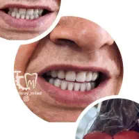 دندان سازی،مصنوعی،دندان متحرک،دندانسازی|خدمات آرایشگری و زیبایی|ارومیه, |دیوار