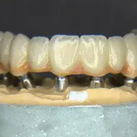 استخدام تکنسین پرسلن گذار (پودرگذار) لابراتوار