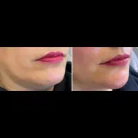 تمامی خدمات پوست و مو|خدمات آرایشگری و زیبایی|شیراز, ابیوردی|دیوار