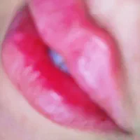 ژل لب بوتاکس