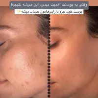 پاکسازی پوست به صورت تخصصی(بانوان)|خدمات آرایشگری و زیبایی|مشهد, آبکوه|دیوار