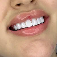 دندانپزشکی با کیفیت بصورت اقساطی|خدمات آرایشگری و زیبایی|شیراز, قدوسی غربی|دیوار