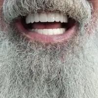 آینده لبخند شما با ایمپلنت های مطمئن|خدمات آرایشگری و زیبایی|تهران, گلستان (شهرک راه آهن)|دیوار