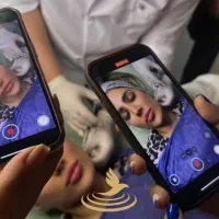 اموزش بوتاکس و ژل با کمترین هزینه ، توسط پزشک