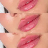 فیلر اقتصادی بوتاکس پیرسینگ