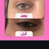 کلینیک زیبایی سلین|خدمات آرایشگری و زیبایی|تهران, خواجه نصیر طوسی|دیوار
