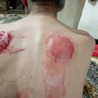 تشخیص عموم بیماری از روی عنبیه چشم|خدمات آرایشگری و زیبایی|شیراز, بید زرد|دیوار
