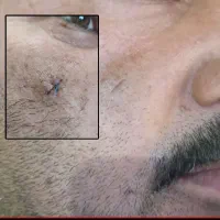 تونیک نانو نقره|آرایشی، بهداشتی، درمانی|شیراز, ستارخان|دیوار