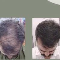 سمت کاشت نرو من هستم